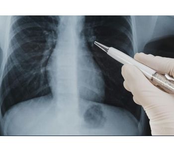 Vuno Med - Chest X-ray Software