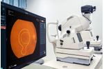 Vuno Med - Version Fundus AI - X-ray Image Analysis Software