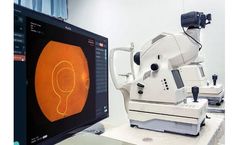 Vuno Med - Version Fundus AI - X-ray Image Analysis Software