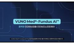 Vuno Med-Fundus AI - Video