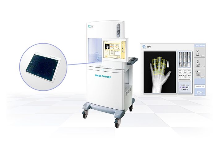 Medi-Future - X-ray Bone Densitometer