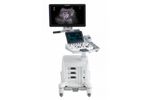 Arietta - Model 50 - Comprehensive Diagnostic Ultrasound System