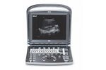 Kiran - Model K2 - Portable and Compact Ultrasound System