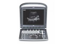 Kiran - Model K2 - Portable and Compact Ultrasound System
