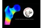 DMS Imaging - 3D-DXA Technology - Video