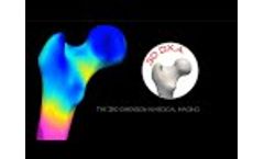 DMS Imaging - 3D-DXA Technology - Video