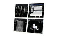 Visaris - Version 360 - Radiology Workstations Software