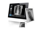Visaris - Digital Radiography Imaging System