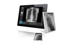 Visaris - Digital Radiography Imaging System