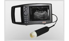 Caresono SonoPalm - Model HD 9200Vet - Veterinary Ultrasound System