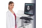 Agfa - Model CR 30-Xm - Mammography and General Radiography System