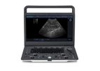 SonoScape - Model E1V - Portable Ultrasound Diagnostic System