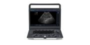 Portable Ultrasound Diagnostic System