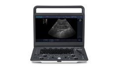 SonoScape - Model E1V - Portable Ultrasound Diagnostic System