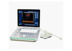 SonoStar - Model C2 - Color Doppler Ultrasound System