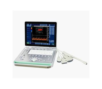 SonoStar - Model C2 - Color Doppler Ultrasound System