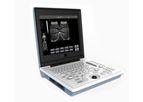 Model SS-6B Laptop - All-Digital Ultrasound Diagnostic System