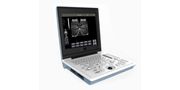 All-Digital Ultrasound Diagnostic System