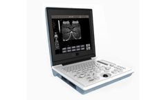 Model SS-6B Laptop - All-Digital Ultrasound Diagnostic System
