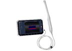 SIFSOF - Model SIFULTRAS-1.3 - Color Transvaginal Ultrasound Scanner 6 Inch Touch Screen, 4-9 MHz