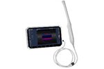 SIFSOF - Model SIFULTRAS-1.3 - Color Transvaginal Ultrasound Scanner 6 Inch Touch Screen, 4-9 MHz