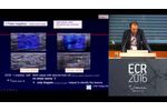 ECR 2016 Symposium - Clinical Innovations Improving Breast Cancer Diagnosis - Prof. Schäfer - Video