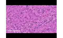 NIO - Laser Imaging System - Video