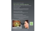 Navilas - Anterior Segment Mode Laser Trabeculoplasty and Laser Peripheral Iridotomy Software - Brochure