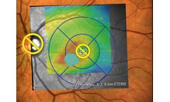 Navilas - Navigated Microsecond Pulsing Software