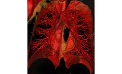 SeeFactor CT3 for Consider Lung Imaging