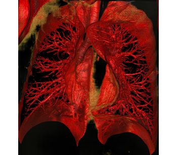 SeeFactor CT3 for Consider Lung Imaging - Medical / Health Care