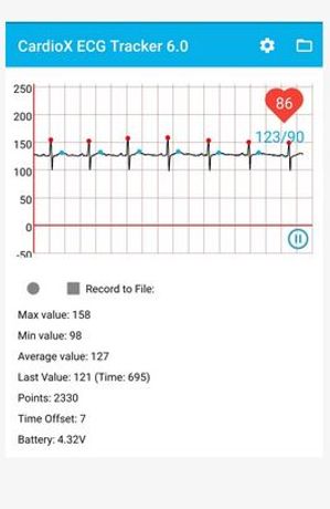 CardioX - Version 6.0 - Mobile App for Wearable ECG Monitor