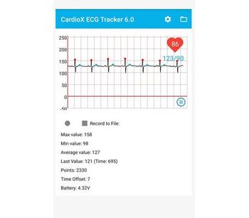 CardioX - Version 6.0 - Mobile App for Wearable ECG Monitor