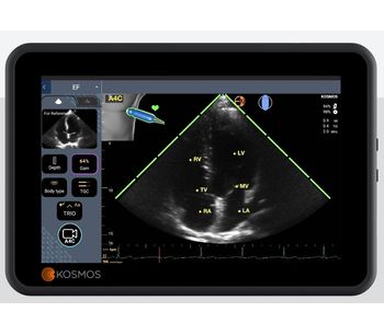 KOSMOS - AI-Assisted Ejection Fraction Workflow Platform