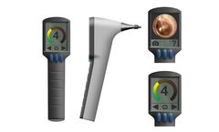 OtoNexus - Technology for Revolutionary Advanced Ultrasound Otoscope