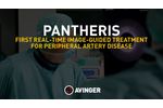 Pantheris the Only Image-Guided Treatment for Peripheral Artery Disease, physicians` testimonial - Video