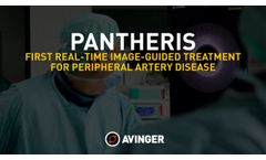 Pantheris the Only Image-Guided Treatment for Peripheral Artery Disease, physicians` testimonial - Video