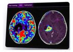 Olea Sphere - Version 3.0 - Neurology Imaging Analysis Software for Improved Patient-Centric Care