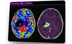 Olea Sphere - Version 3.0 - Neurology Imaging Analysis Software for Improved Patient-Centric Care