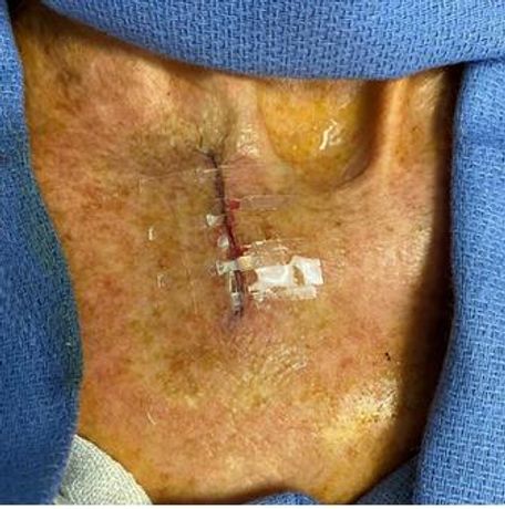 Surgical Skin Closure for Surgeons - Medical / Health Care - Clinical Services