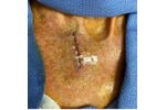 Surgical Skin Closure for Surgeons - Medical / Health Care - Clinical Services