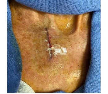 Surgical Skin Closure for Surgeons - Medical / Health Care - Clinical Services