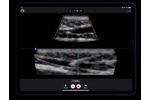 Ultrasound for EMS - Medical / Health Care - Clinical Services