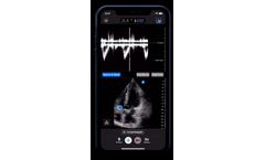 Ultrasound for Cardiology