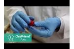 Collagen Matrix - Orthopaedic OssiMend Putty - Product Demo - Video