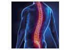Histocell - Model HC016 - Acute Spinal Cord Injury Platform