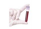 Prostadiag Colodiag - Accurate Blood-Based Test Kit for Colorectal Cancer