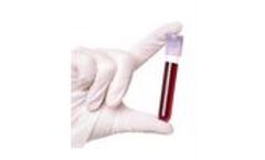 Prostadiag Colodiag - Accurate Blood-Based Test Kit for Colorectal Cancer