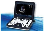 Lambda - Model P9 - Cardiovascular Portable Ultrasound System