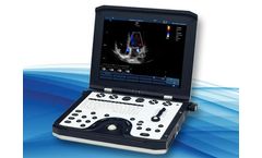 Lambda - Model P9 - Cardiovascular Portable Ultrasound System